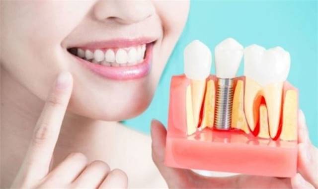 Dental Implants Thornton | Dentist in Thornton CO | Local Dentist 80241 | Timber Dental Care