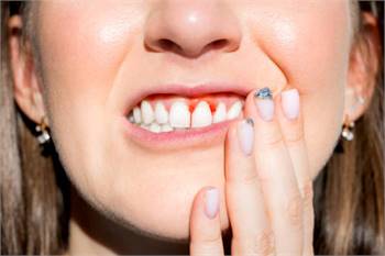 Periodontal Gum Disease – Grand Prairie, TX